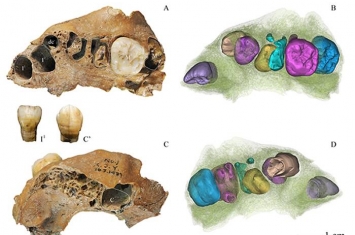 东亚古人类牙齿生长发育研究新进展