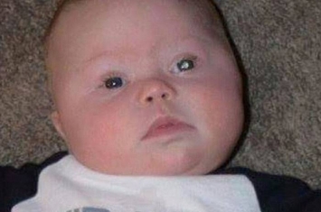 美国男婴每次闪光灯拍照时左眼都出现白光 向医生查询后发现患眼癌