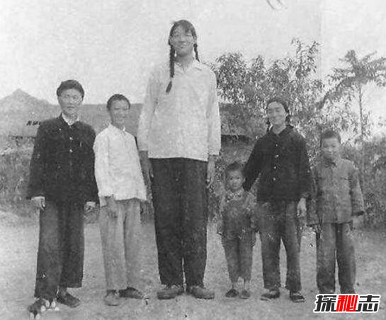 世界第一高人王峰军，真实身高2.33米(谎报2.55米)
