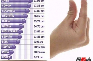世界上丁丁最短小的男人 竟然只有1厘米(性器官发育不全)