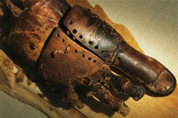 世界上最古老的假肢 它们是木乃伊的假肢（完整的死去）