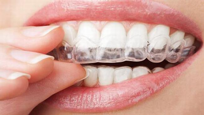 带牙套可以使用电动牙刷吗 可以（哪种牙刷都可以）