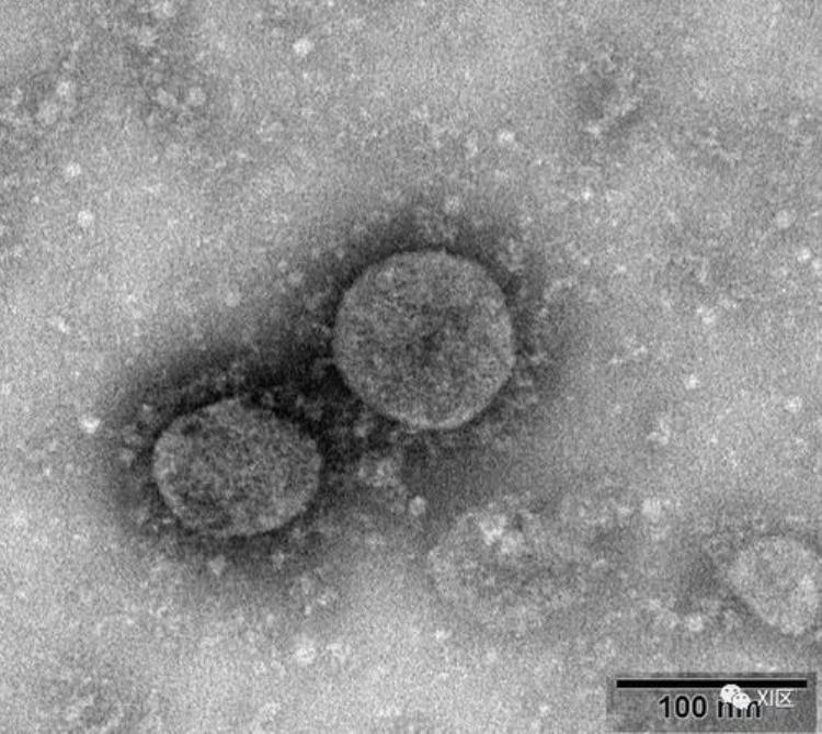 新冠病毒是怎么发展的,新冠病毒的来源