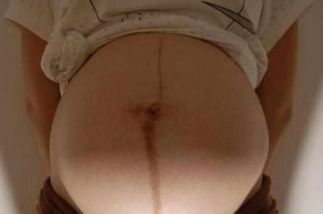 孕期肚子偏右是为什么,孕妇肚脐中间有条黑线
