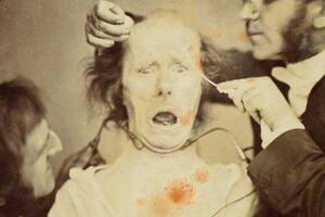 达尔文最后的恐怖实验，用电击人类脸部收集表情(图片)