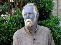 蓝肤症，平均寿命高达80岁/缺乏铁元素和铜元素