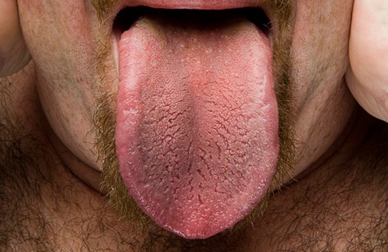 世界最长的舌头