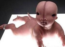 苏联外星婴儿事件，外星飞船逃生舱发现外星婴儿（1年后死）