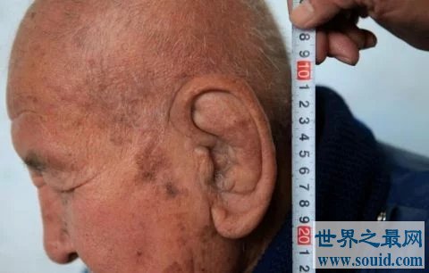 世界上最大的耳朵，长约11厘米，网友:弥勒佛转世？
