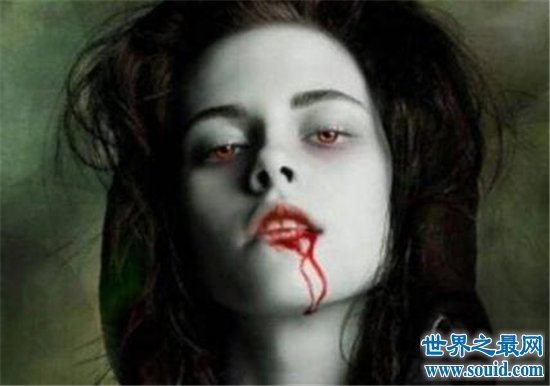 世界上最可怕的怪病，一起来看一下啊吸血鬼症多可怕！