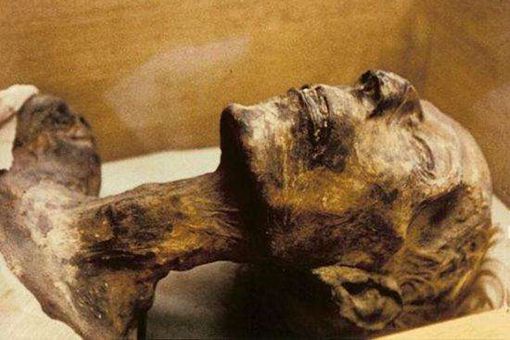 埃及法老图特安哈门为何英年早逝?