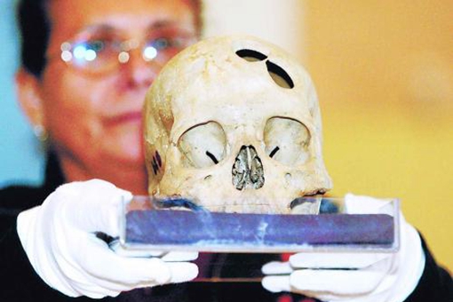 印加人在5000年前就拥有了开颅手术的技术?他们是怎么做到的?