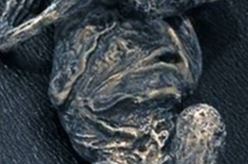 外星人尸体？1996年俄罗斯老奶奶发现的“侏儒小矮人”被证实是核灾难畸形人类婴儿