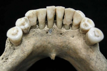 德国1000年前下葬的女性嘴里发现珍贵的蓝色青金岩