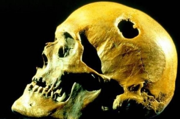 颅骨穿孔术：史前人类为什么要在头骨上钻孔？