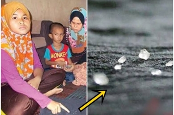 马来西亚10岁女童揉眼揉出“水晶”