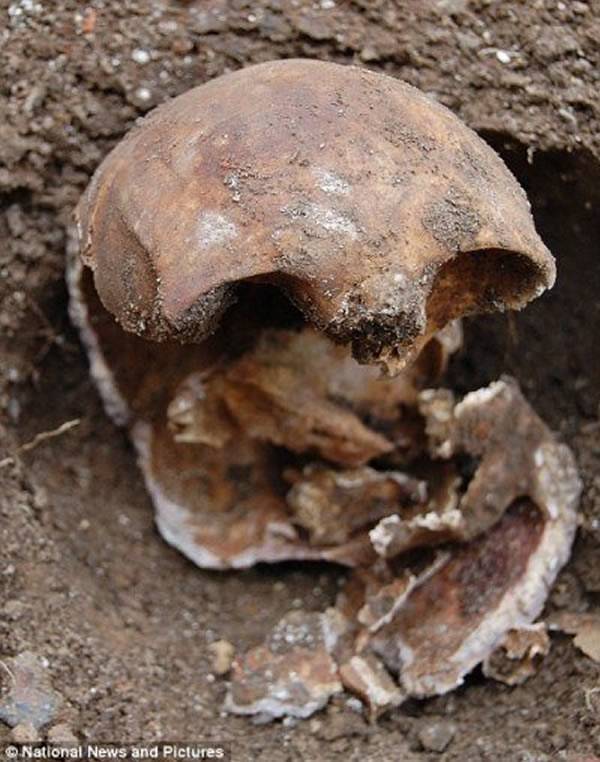 英国居民后院挖出132年前头骨破百年悬案
