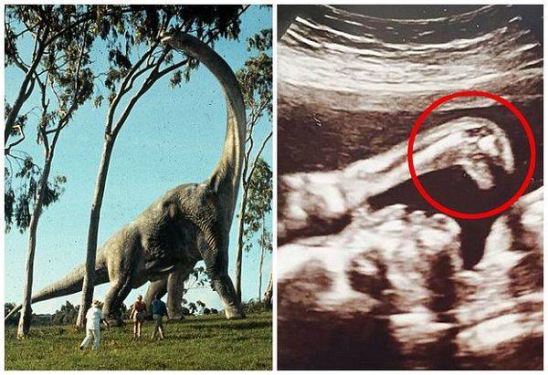 英国孕妇B超扫描图像惊现《侏罗纪公园》电影中的恐龙