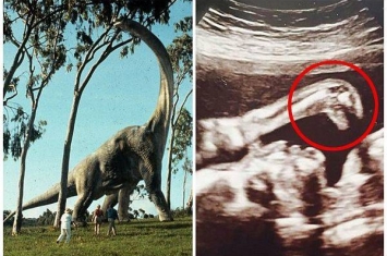 英国孕妇B超扫描图像惊现《侏罗纪公园》电影中的恐龙