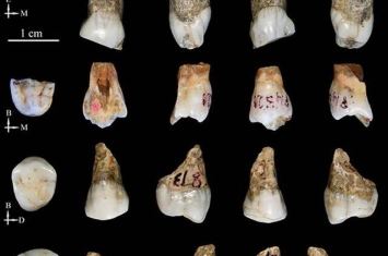 桐梓人牙齿形态的最新研究成果