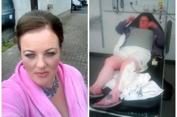 英国北爱尔兰妇人遭全英最毒的“假寡妇蜘蛛”咬伤