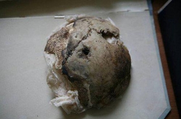 揭秘希特勒头盖骨之谜,希特勒尸体真的被换过吗?