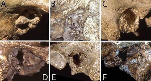 《PLoS One》：耳道内异常的骨质增生“游泳者耳病”在尼安德特人中非常普遍