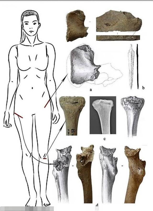亚美尼亚古墓出土骸骨或是传说中的亚马逊女战士