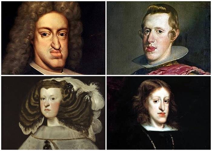 奥地利哈布斯堡王朝近亲通婚致多数人脸部畸形