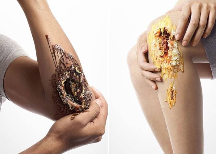 泰国糖尿病协会制作糖尿病海报 将朱古力等甜点放入溃烂伤口中以达到“触目惊心”