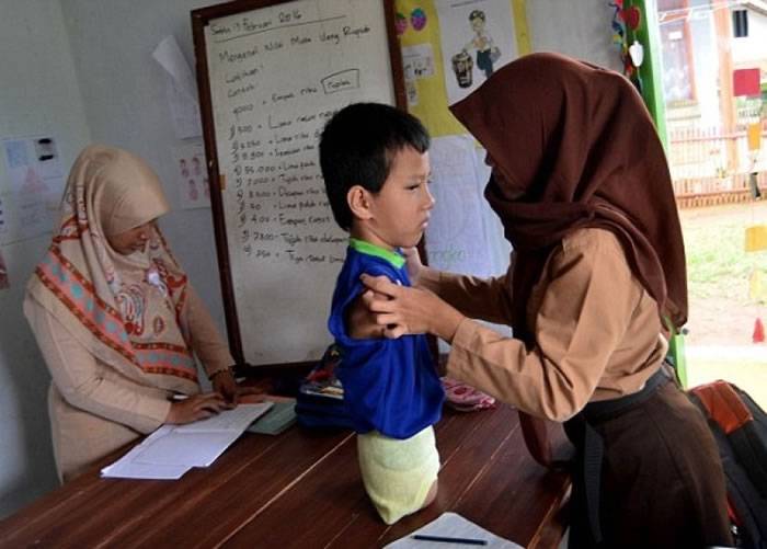 印尼11岁男童Tiyo Satrio天生无手脚 乐观克服重重障碍