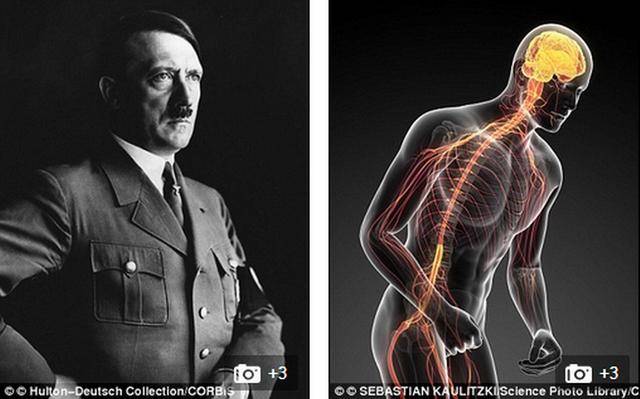 最新研究表明帕金森综合症对于阿道夫-希特勒的失败起到至关重要作用