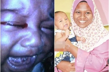 马来西亚女婴出生5天后便流出“血泪” 结膜炎所致