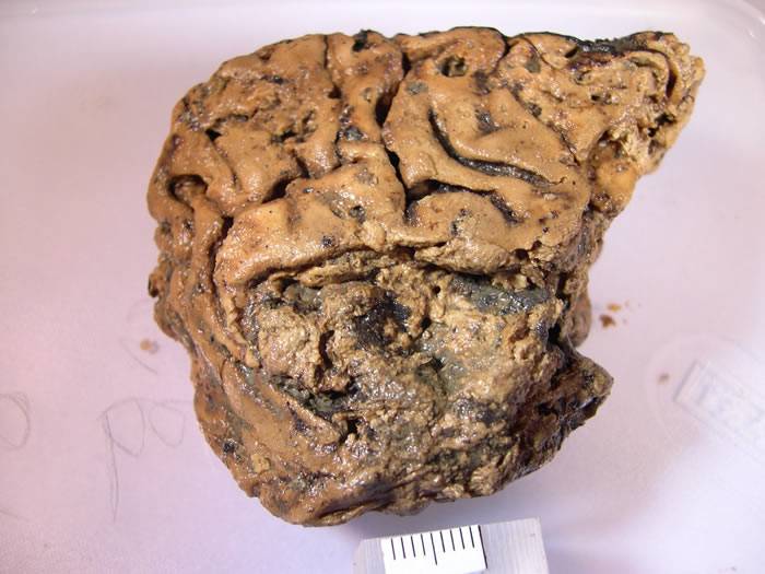 英国约克郡2600年前被杀古人颅骨内发现保存完好的神秘脑组织