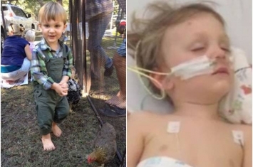澳洲昆士兰2岁男童在家中鸡棚拾鸡蛋时被全球第二毒太攀蛇咬伤奇迹复活