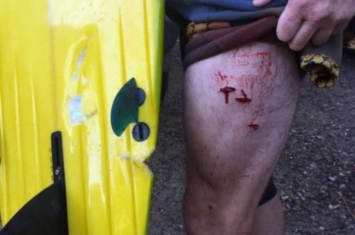 澳洲新南威尔士省海岸滑浪者遭鲨鱼咬伤 一个月内第3宗