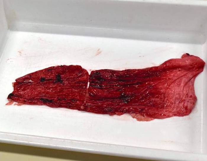 日本名古屋护城河捕获外来种肉食鱼“鳄雀鳝” 剖开后胃里空无一物