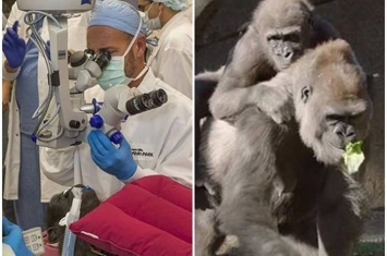 美国加州圣迭戈动物园大猩猩接受白内障手术治疗