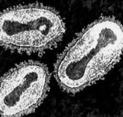 世界上第一个被消灭的病毒：天花，杀死5亿人（牛痘防治）