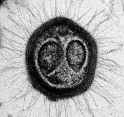 世界上最大的病毒，米米病毒直径800纳米（酷似细菌）