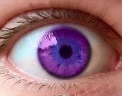 全球最稀有的眼睛，紫色眼睛全世界只有600个人拥有