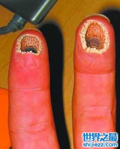 这么恶心的空手指图片你们见过吗，其实这是恶搞