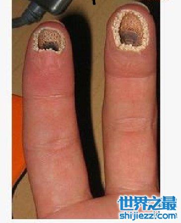 这么恶心的空手指图片你们见过吗，其实这是恶搞