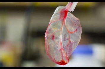 “菠菜心脏”与人体组织的结合 如何用菠菜叶脉来代替？