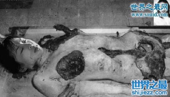 海豹人，被残忍砍掉四肢的悲惨女兵(越南士兵暴行)