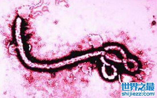 埃博拉病毒僵尸变异，恐怖僵尸病毒患者竟会诈尸