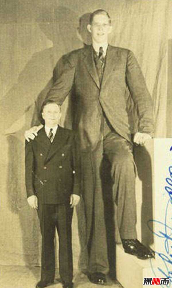 世界上最大的人:罗伯特·潘兴·瓦德罗(高达2米72)