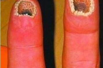 恶心的空手指图片竟是假的，是ps出来的恶搞图片