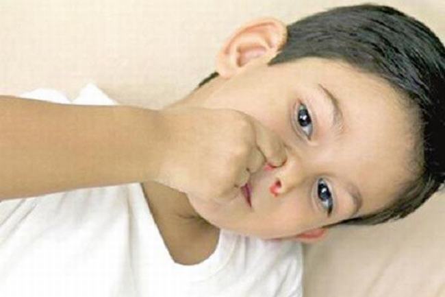 鼻子出血是什么原因?流鼻血是什么病的前兆