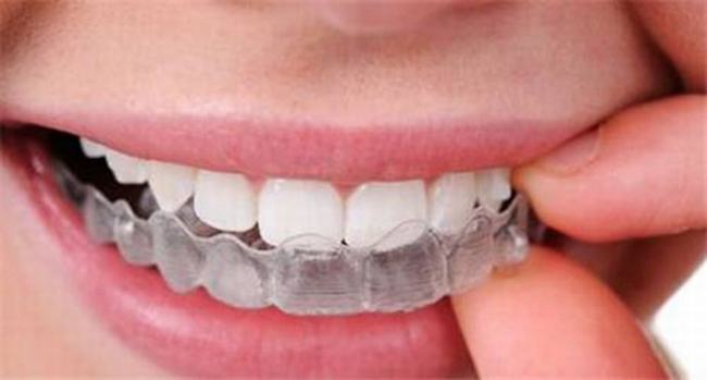 矫正牙齿对以后有影响吗?矫正牙齿利与弊有哪些?